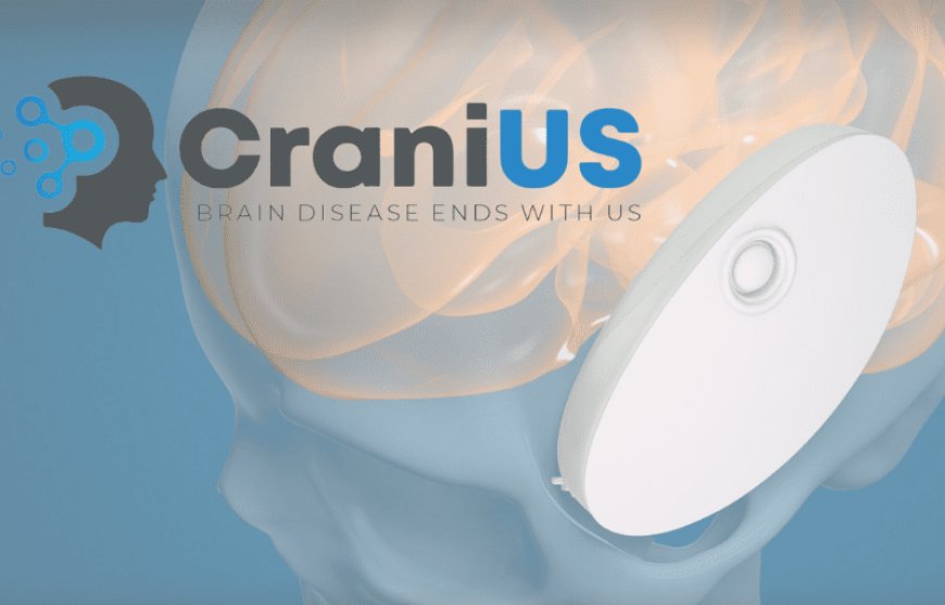 Opening a New Frontier in Drug Delivery to the Brain: Featuring CraniUS CEO, Michael Maglin